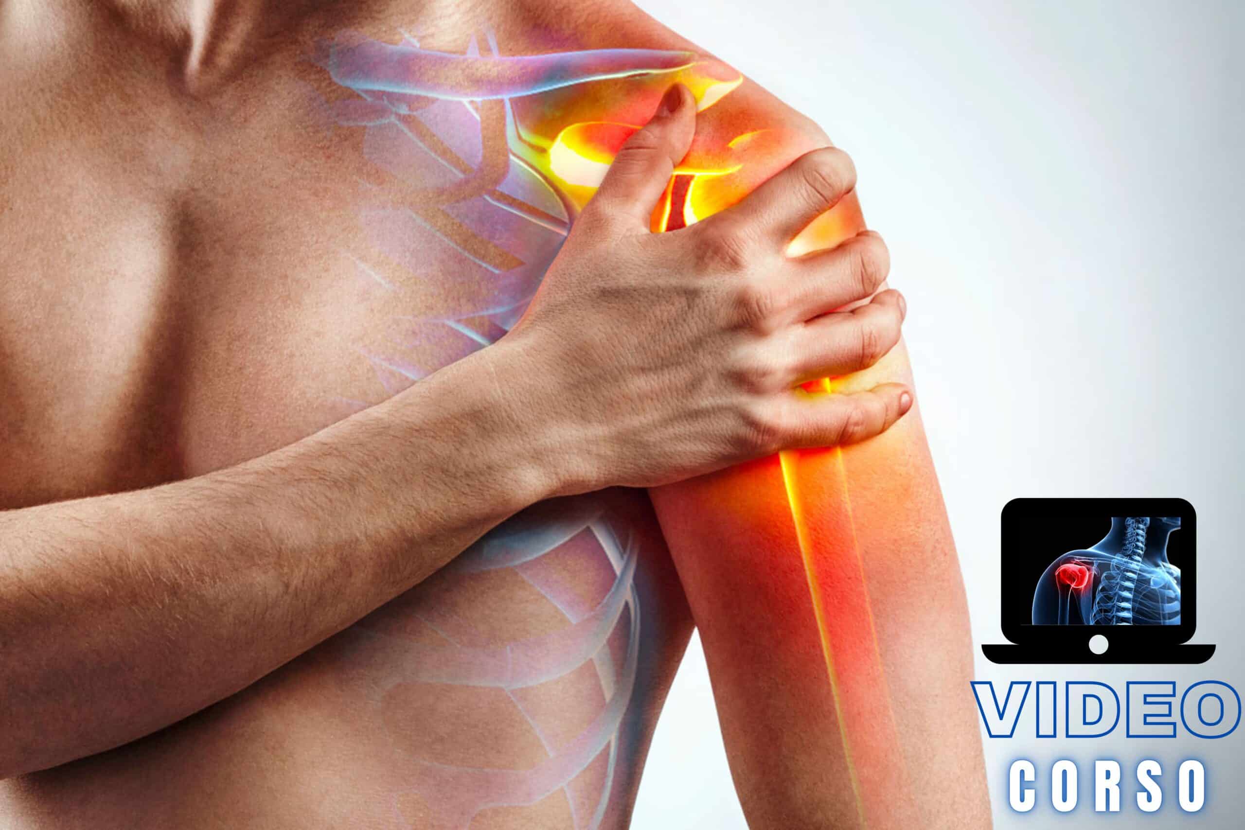 La patologia della cuffia dei rotatori: valutazione e trattamento - immagine 2